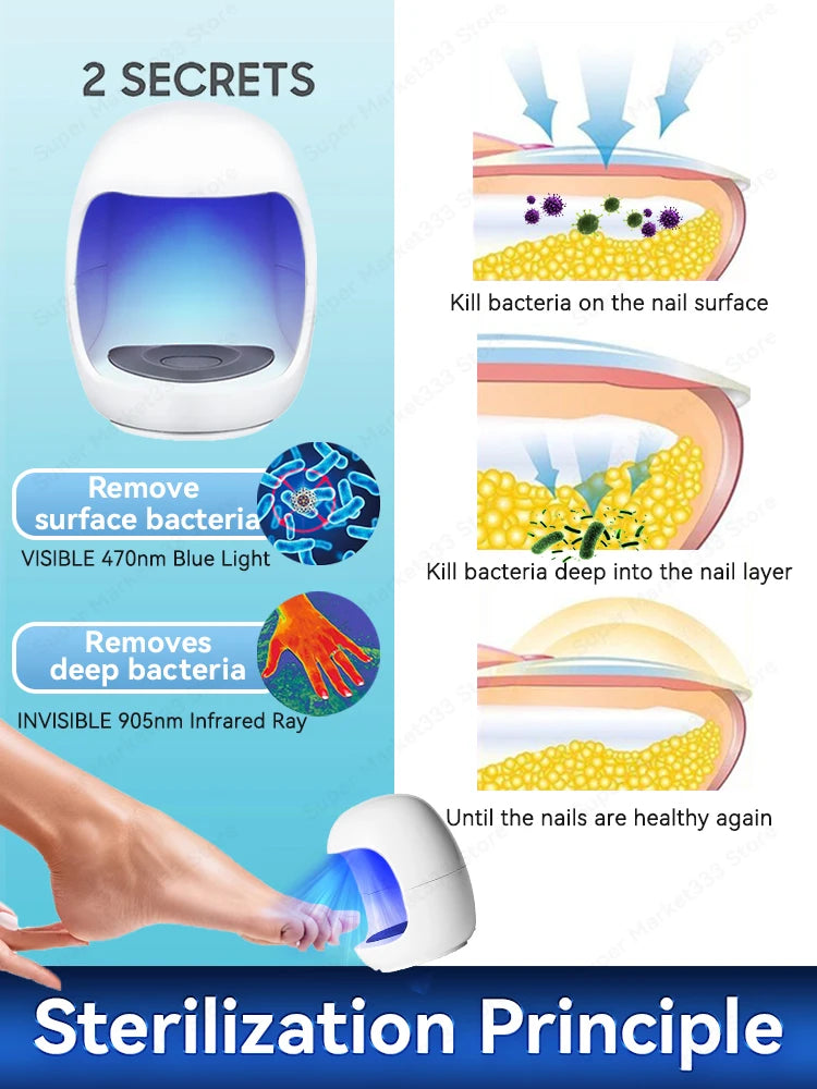 Laser Nail Therapy Device – Effective Solution for Nail Problems