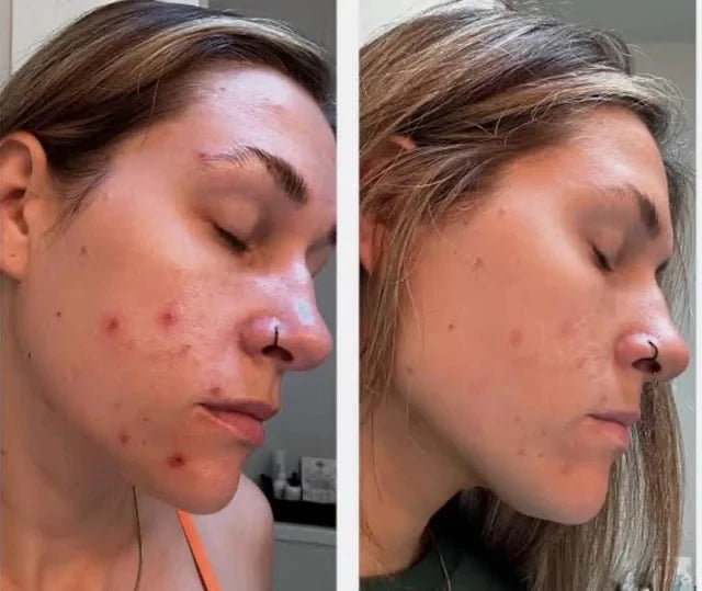 Beef Tallow Face Cream – Moisturizing, Soothing & Firming Skincare