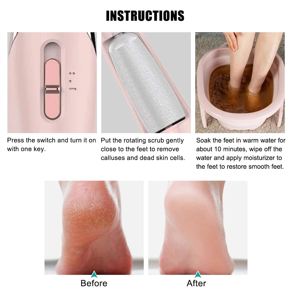 Electric Foot File Pedicure Tool – Portable Callus Remover and Dead Skin Grinder