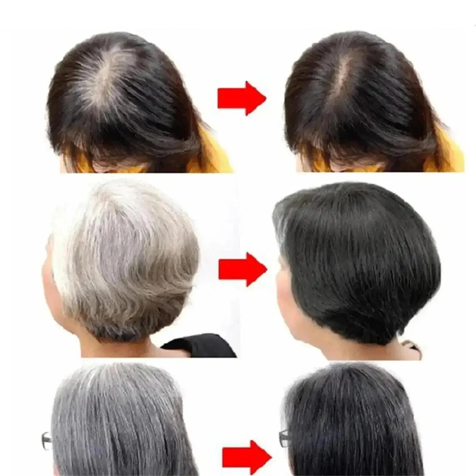 Gray to Black Hair Treatment Serum