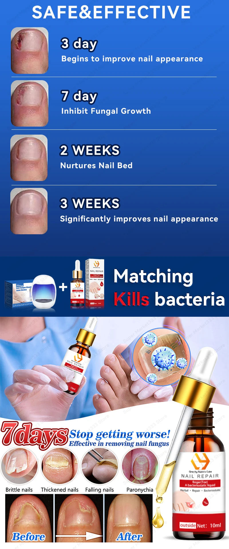 Laser Nail Therapy Device – Effective Solution for Nail Problems