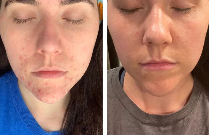 Beef Tallow Face Cream – Moisturizing, Soothing & Firming Skincare