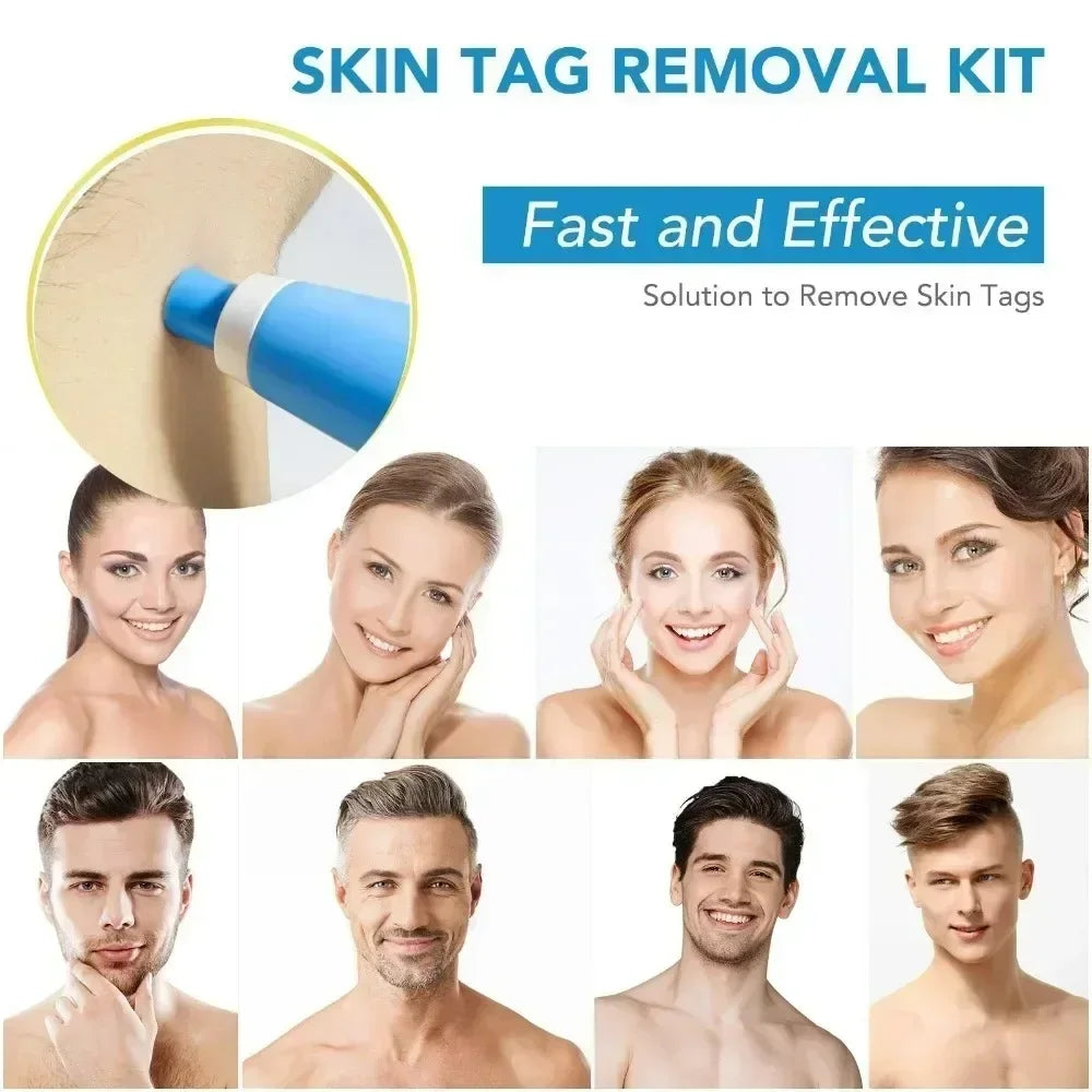 2-in-1 Acne & Skin Tag Remover Device – Mole, Wart & Blemish Removal Kit