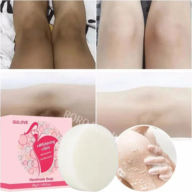 Body Whitening Soap – Deep Brightening & Nourishing for Knees