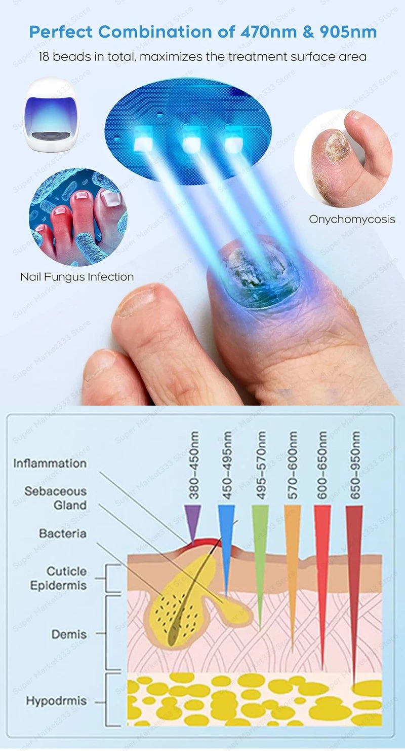 Laser Nail Therapy Device – Effective Solution for Nail Problems