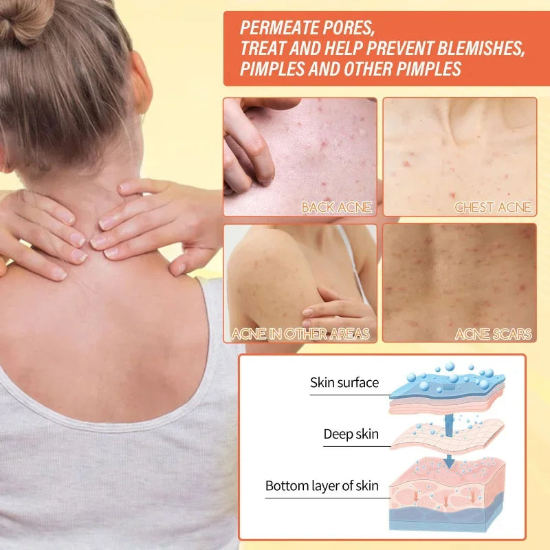 Body Whitening Soap – Deep Brightening & Nourishing for Knees