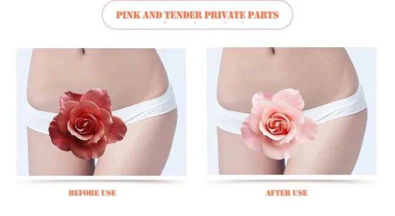 Body Whitening Soap – Deep Brightening & Nourishing for Knees