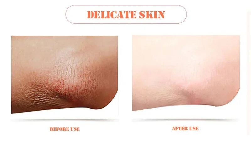 Body Whitening Soap – Deep Brightening & Nourishing for Knees