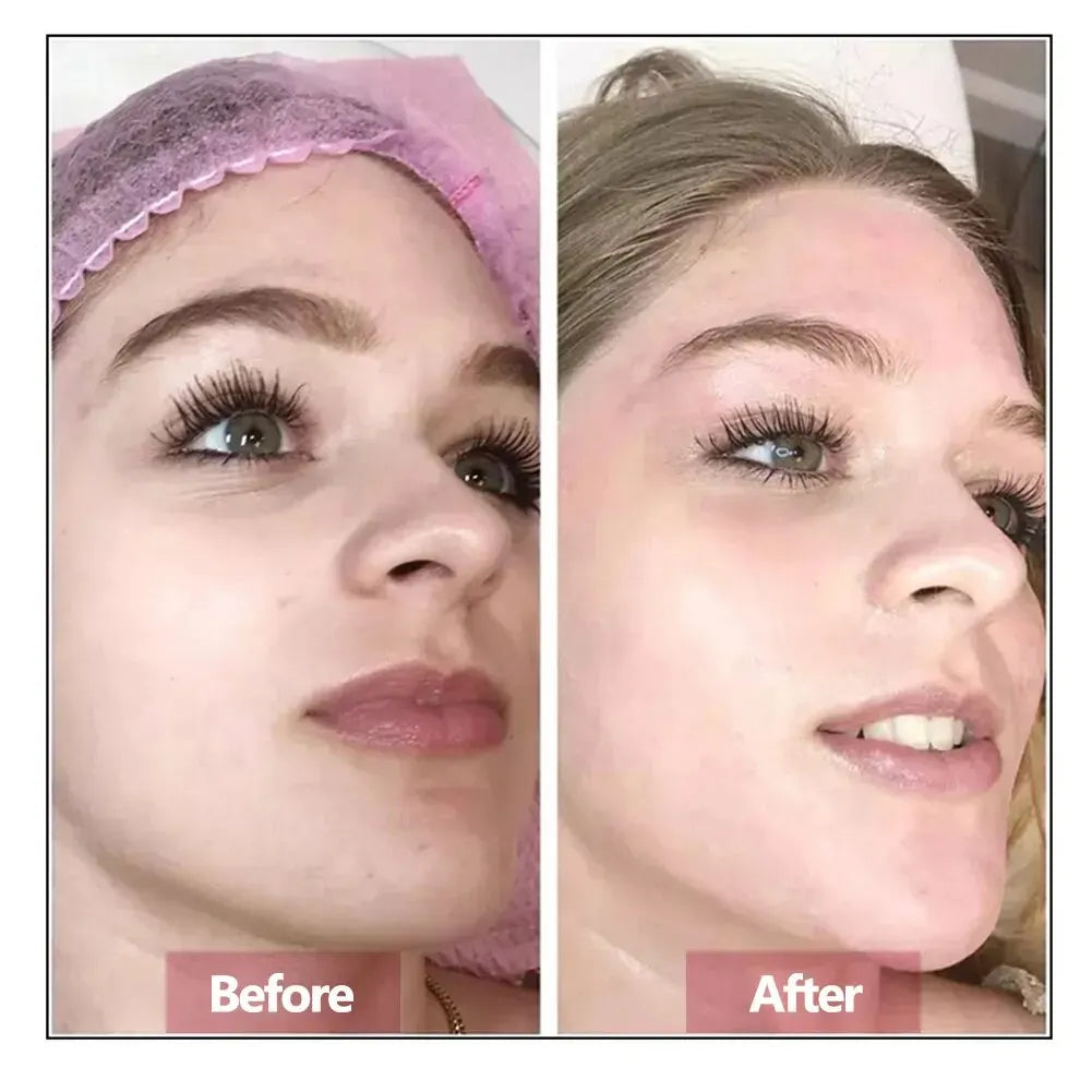 Hyaluronic Acid Face Serum – Hydrating, Firming & Anti-Aging Essence