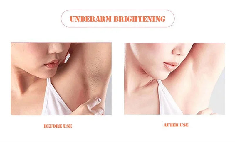 Body Whitening Soap – Deep Brightening & Nourishing for Knees