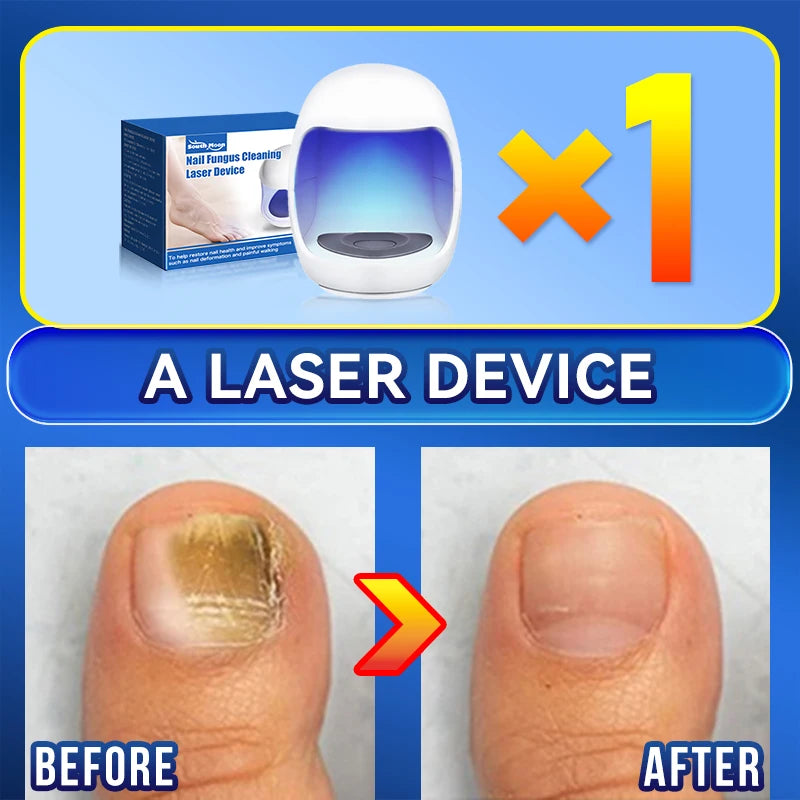 Laser Nail Therapy Device – Effective Solution for Nail Problems