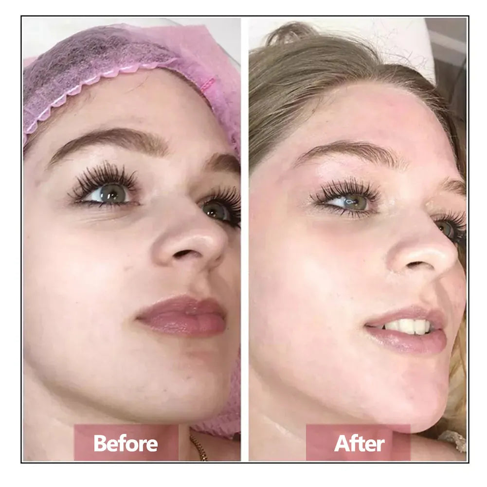 Hyaluronic Acid Face Serum – Hydrating, Firming & Anti-Aging Essence