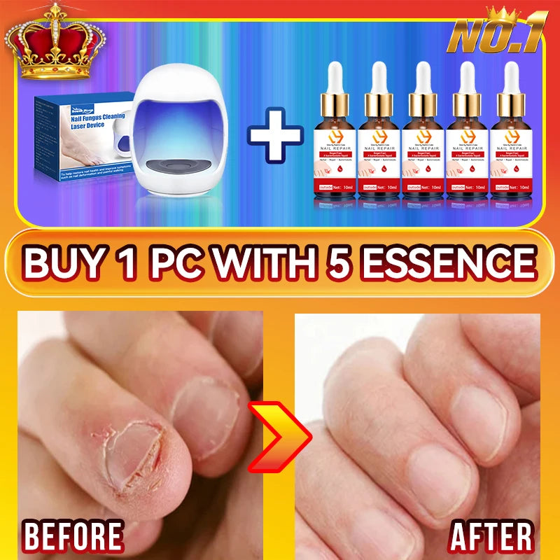Laser Nail Therapy Device – Effective Solution for Nail Problems