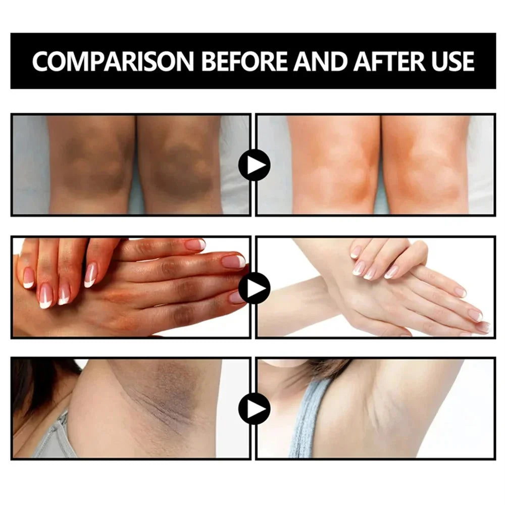 Body Whitening Soap – Deep Brightening & Nourishing for Knees