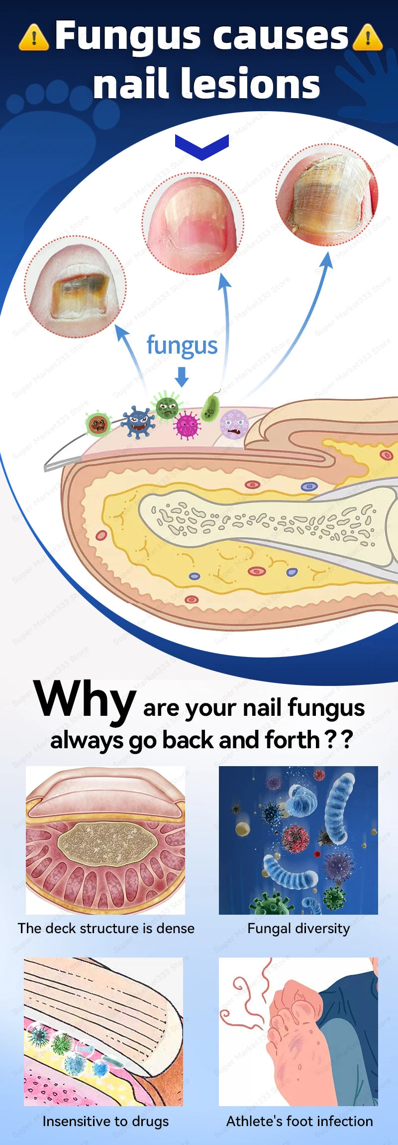 Laser Nail Therapy Device – Effective Solution for Nail Problems