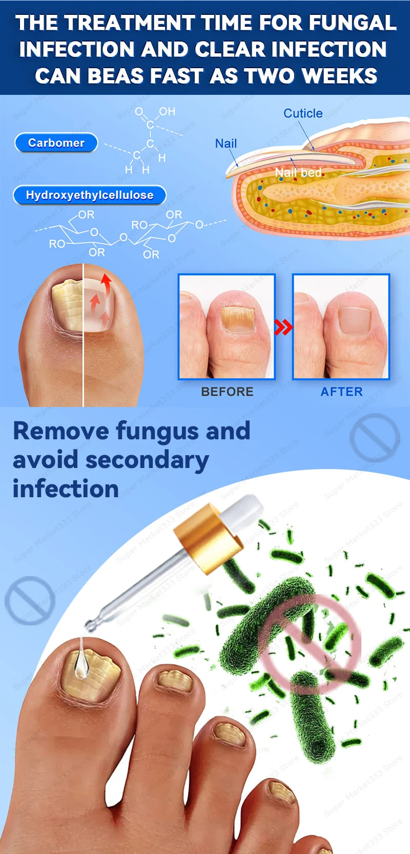 Laser Nail Therapy Device – Effective Solution for Nail Problems