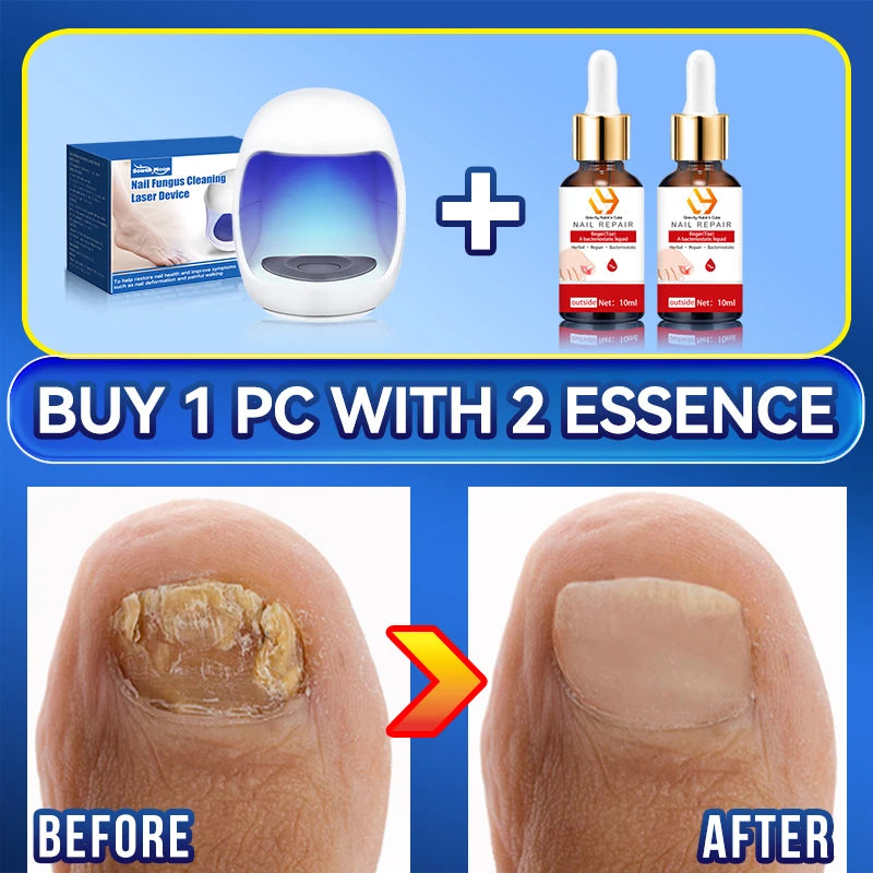 Laser Nail Therapy Device – Effective Solution for Nail Problems